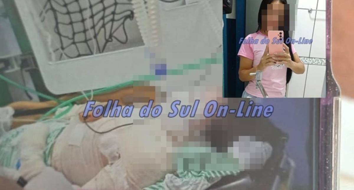 Mulher de 42 anos despeja acetona no próprio corpo e ateia fogo em Rondônia