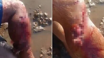 Pescador fica gravemente ferido após ser atacado por jacaré de grande porte no Rio Araguaia