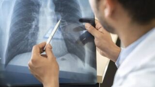 Anvisa aprova dois novos medicamentos contra o câncer de pulmão e de mama no Brasil