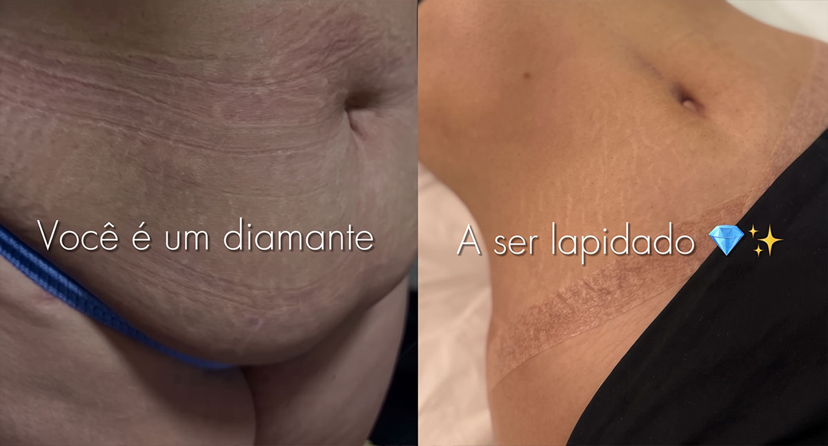 Cirurgia plástica: cada transformação começa com cuidado e avaliação