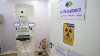 SBRT alerta para diagnóstico tardio do câncer de mama em homens durante o Outubro Rosa